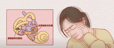 不敢翻身、不敢起床、不敢转头——只有耳石症的人才懂